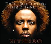 YoungFyre (Krizz Kaliko vitiligo May 6th cop it!) profile picture