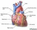 heart_disease_treatment