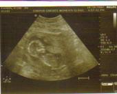 * MoMmY tO bE!!* profile picture