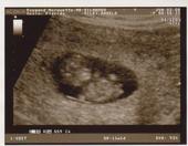 IT'S A GIRL!! profile picture