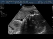 7 WEEKS TiLL MY LiL MAN iS HERE<3 [iTS A BOY!] profile picture