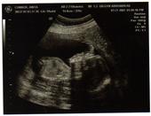 It's A boy!!! profile picture