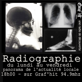 Radiographie profile picture