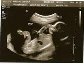 It's a Boy ♥ (&& hE's AlMoS profile picture