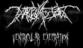 Ventricular Execration profile picture