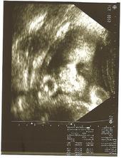 *Spemo Kid* it's a boy :] profile picture