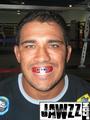 Jawzz Custom Mouthguards and The Fightdentist.com profile picture