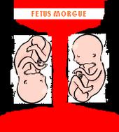 Fetus Morgue profile picture