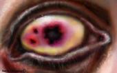 infected pupils profile picture