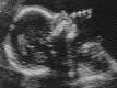 Unborn Baby profile picture