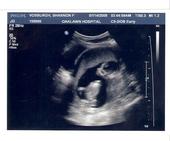 EXPECTING MOMMY TO A LITTLE BOY!!!! profile picture