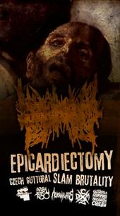 EPICARDIECTOMY (2 NEW Track Uploaded) profile picture