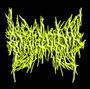 EPICARDIECTOMY (2 NEW Track Uploaded) profile picture