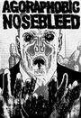 Agoraphobic Nosebleed profile picture