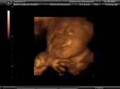 Daddy to Be!..its a Girl! profile picture