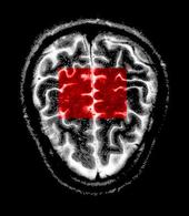 Lateral Neurons [of Amygdala] profile picture