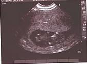 WE'RE HAVING A BABY! profile picture