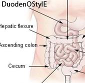 duodenostyle