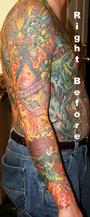 Rethink Your Ink Laser Tatttoo Removal & Editi profile picture