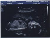 SuperrCharged Killa [Its a Boy!]! profile picture