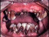 Meth Mouth profile picture