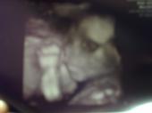 ITS A GIRL ♥ profile picture