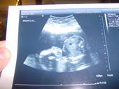 Jaren is going to have a little sister! profile picture