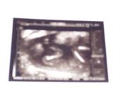 yadada thizzness IM FITTEN TO BE A DADDY!!!!!! profile picture