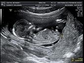 MOMMY TO BE ♥ profile picture