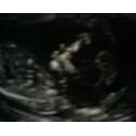 We're Having A Girl!!!!!!!!!!!!!!! profile picture