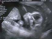 ITS A GIRL!!!!! profile picture