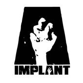 Implant profile picture