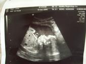 ~*IT'S A GIRL!!!!!! LaNaiyah is My World!!!!*~ profile picture