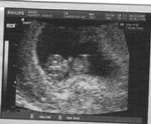 *MRS. ApONte* ITS A GIRL...!!! profile picture