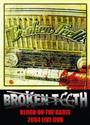 BROKEN TEETH UK profile picture