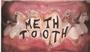 METH TOOTH needs bassist & vocalist!!! profile picture