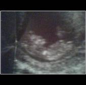 Cant wait till my princess is here 10-29-09 profile picture