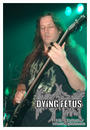 Dying Fetus profile picture