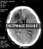 Encephalic Suicide profile picture