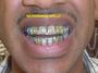 (SHAKIM) NATIONWIDE GRILLZ & JEWELZ profile picture