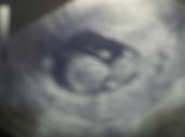 alissas gonna have a baby!!!! profile picture