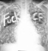 Cystic Fibrosis 4 Life profile picture